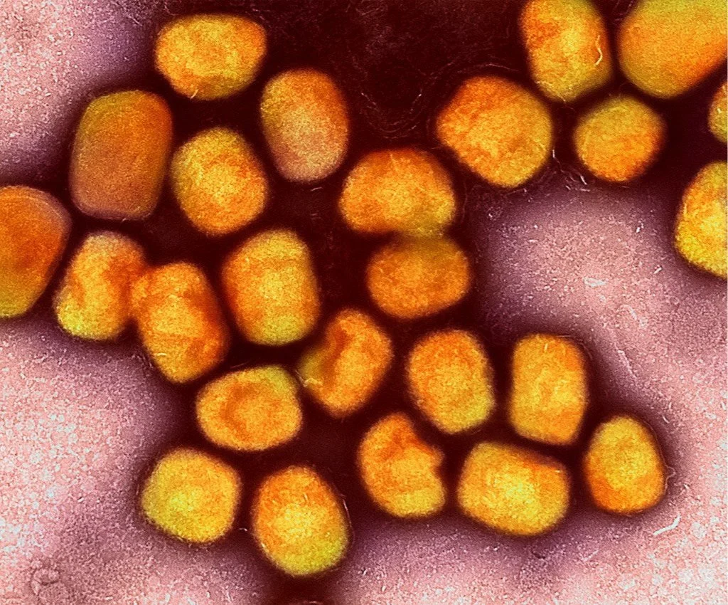 Am I at Risk of Catching Monkeypox?