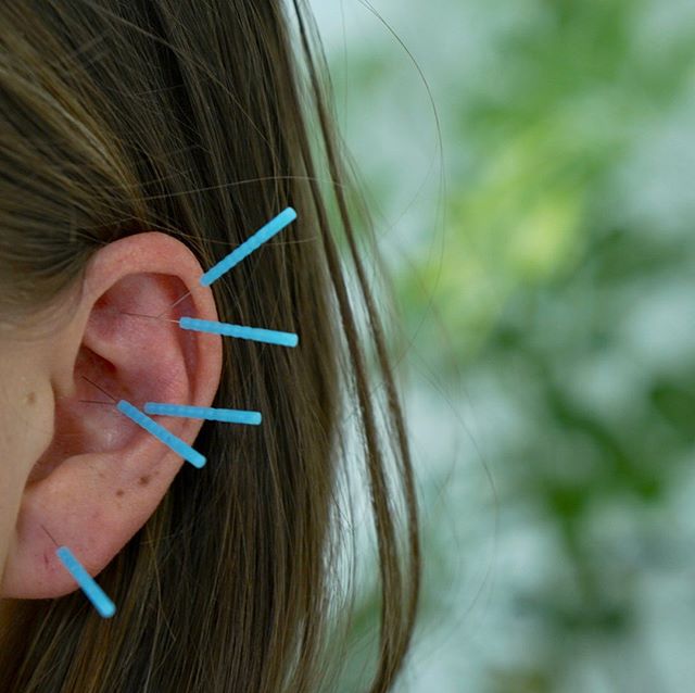 Community ear clinic tomorrow in Ojai! 10-1:30 We can treat the entire body through the microcosm of the ear. Walk-ins welcomed! DM or email for info.  #ojai #earacupuncture #acupuncture #ojailove #ojaienergetics