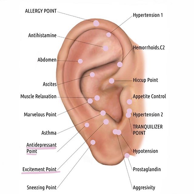 Last week in Ear Clinic, we used the antidepressant and excitement (joy) points a lot. We&rsquo;ve been having unusually cloudy weather here in Ojai, and a lot of people were feeling down. These points can make a big difference in mood- although ther