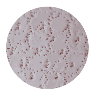 nyc-adl_procell-channels-new-penstyle.png