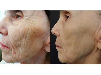 procell-results-5-copy.jpg