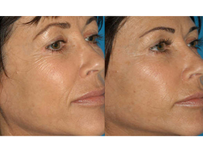 procell-results-4-copy-1opt.png