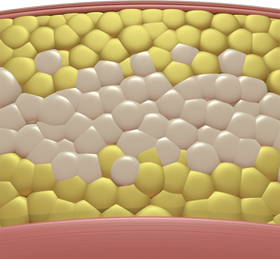 nyc-adl_sculpsure-4.png