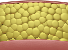 nyc-adl_sculpsure-5.png