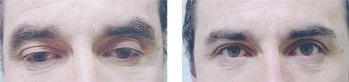 lshr-before-after08.jpg
