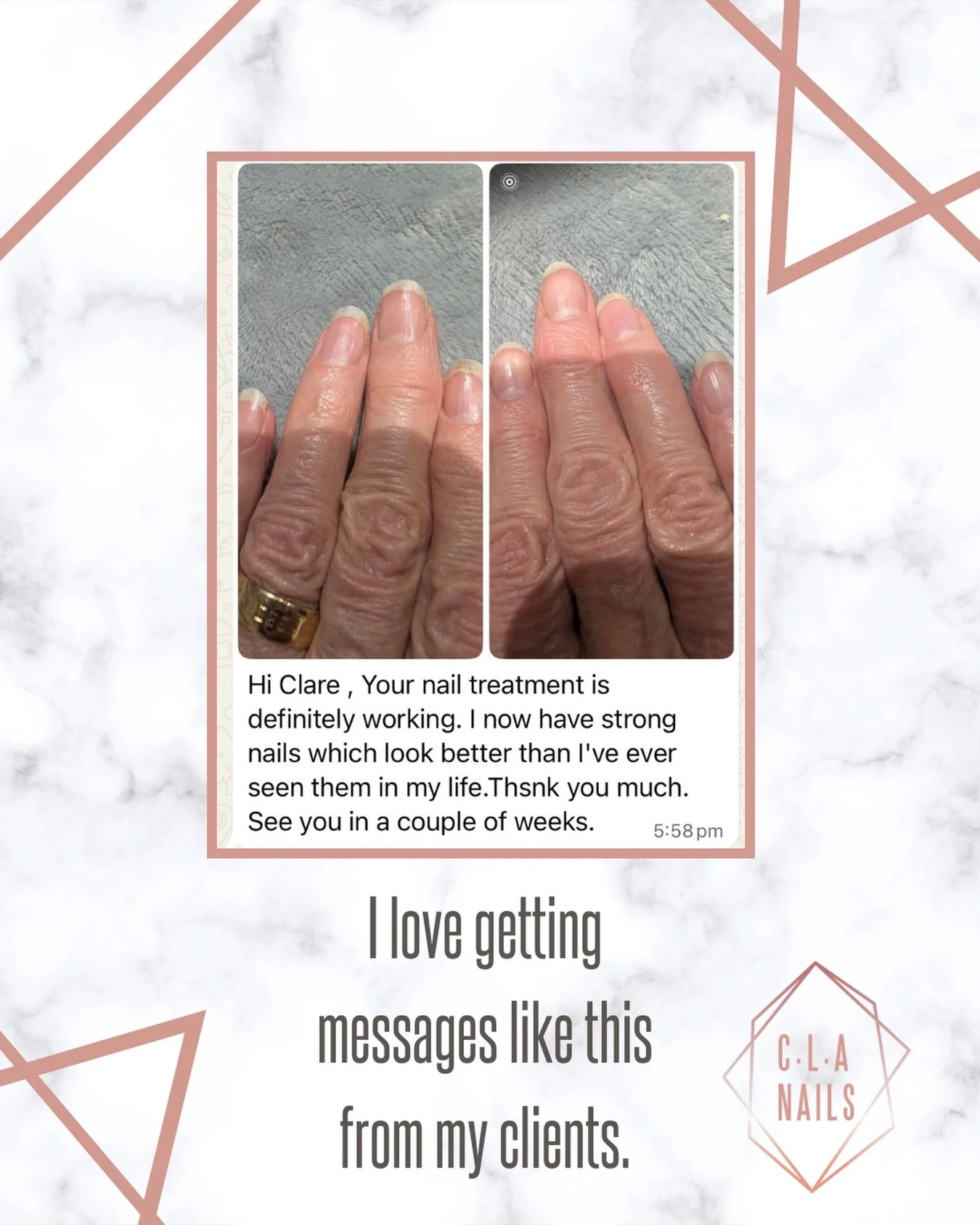 My passion is helping people with their nails and getting messages like this really makes my day. 🤍🤍