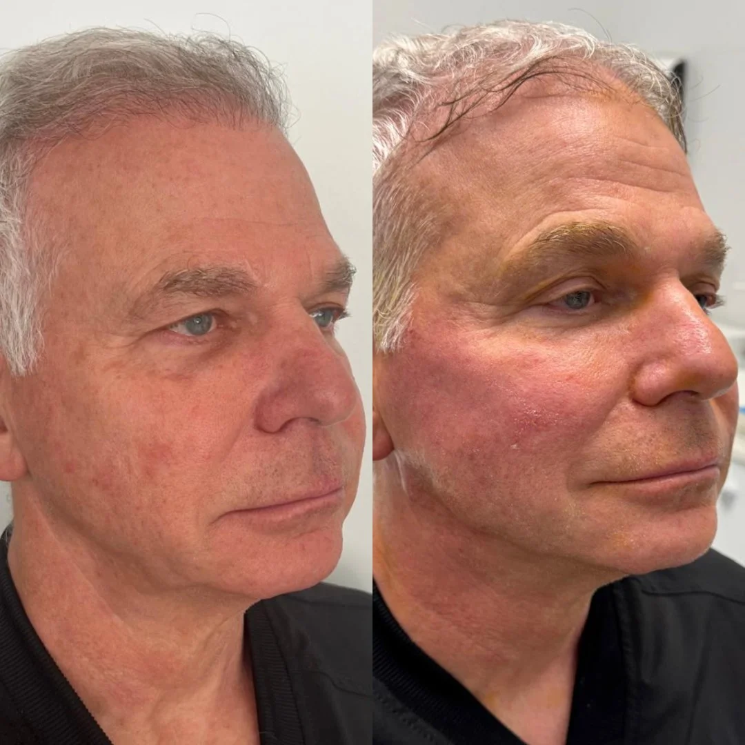 JB before and After 2.jpg