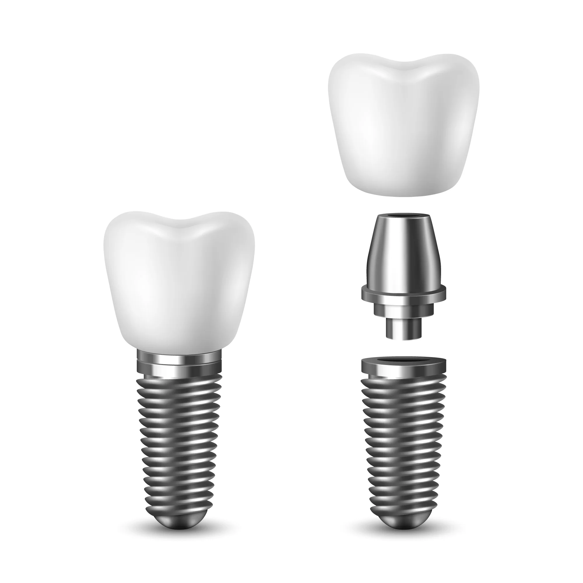 Dental Implants — Memphis Dentures and Implants