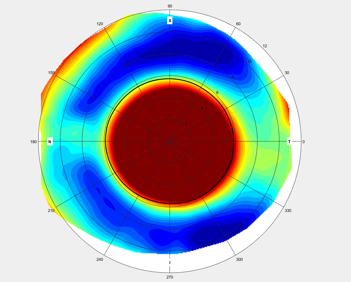 Smap Scleral 3d Imaging Cli Nevada