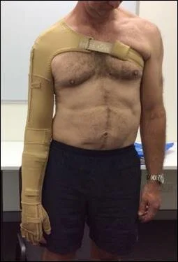 Splintblog.jpg