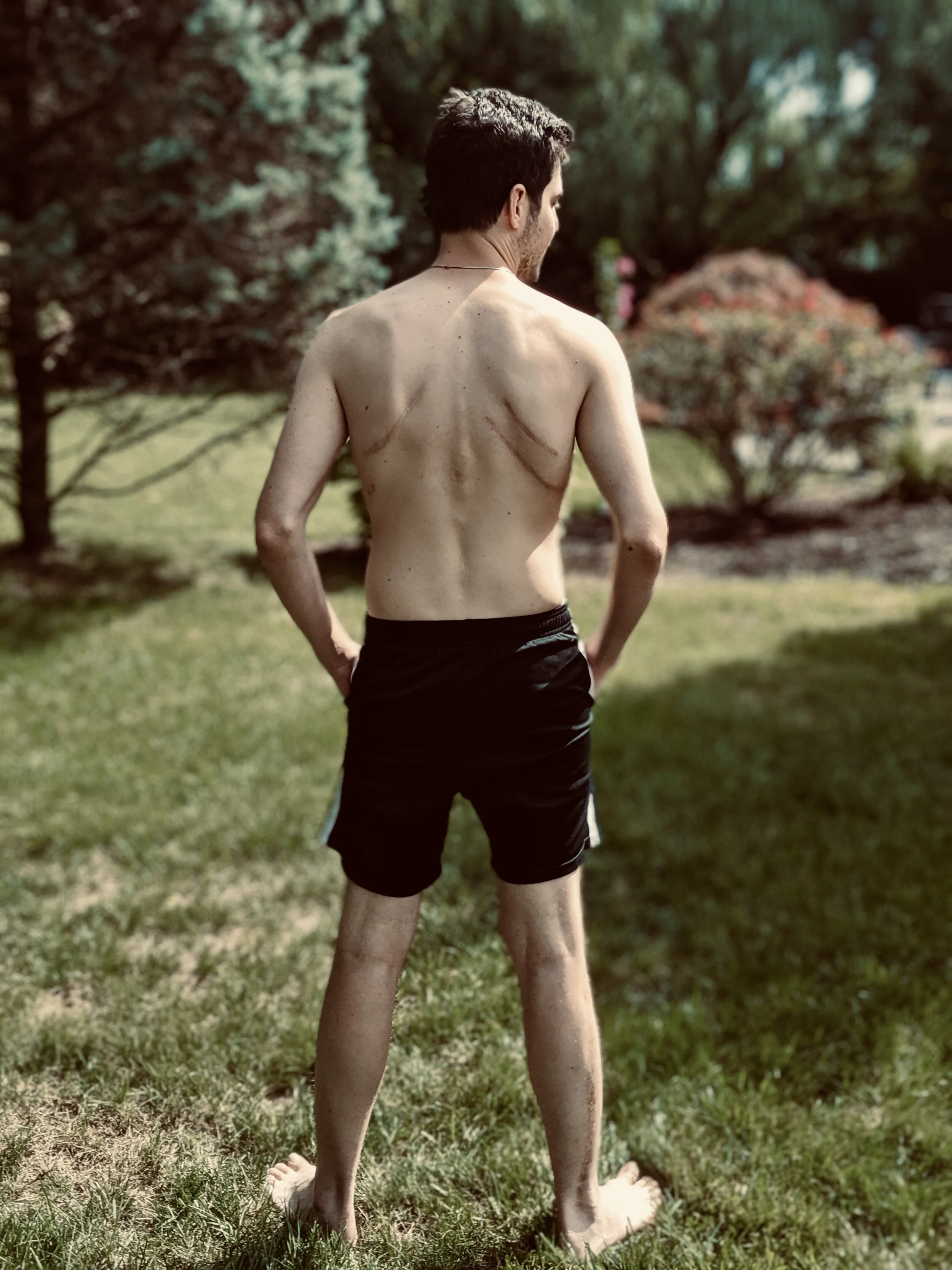 The Mindset of a Champion Cancer Fighter