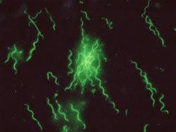 img-borrelia.jpg