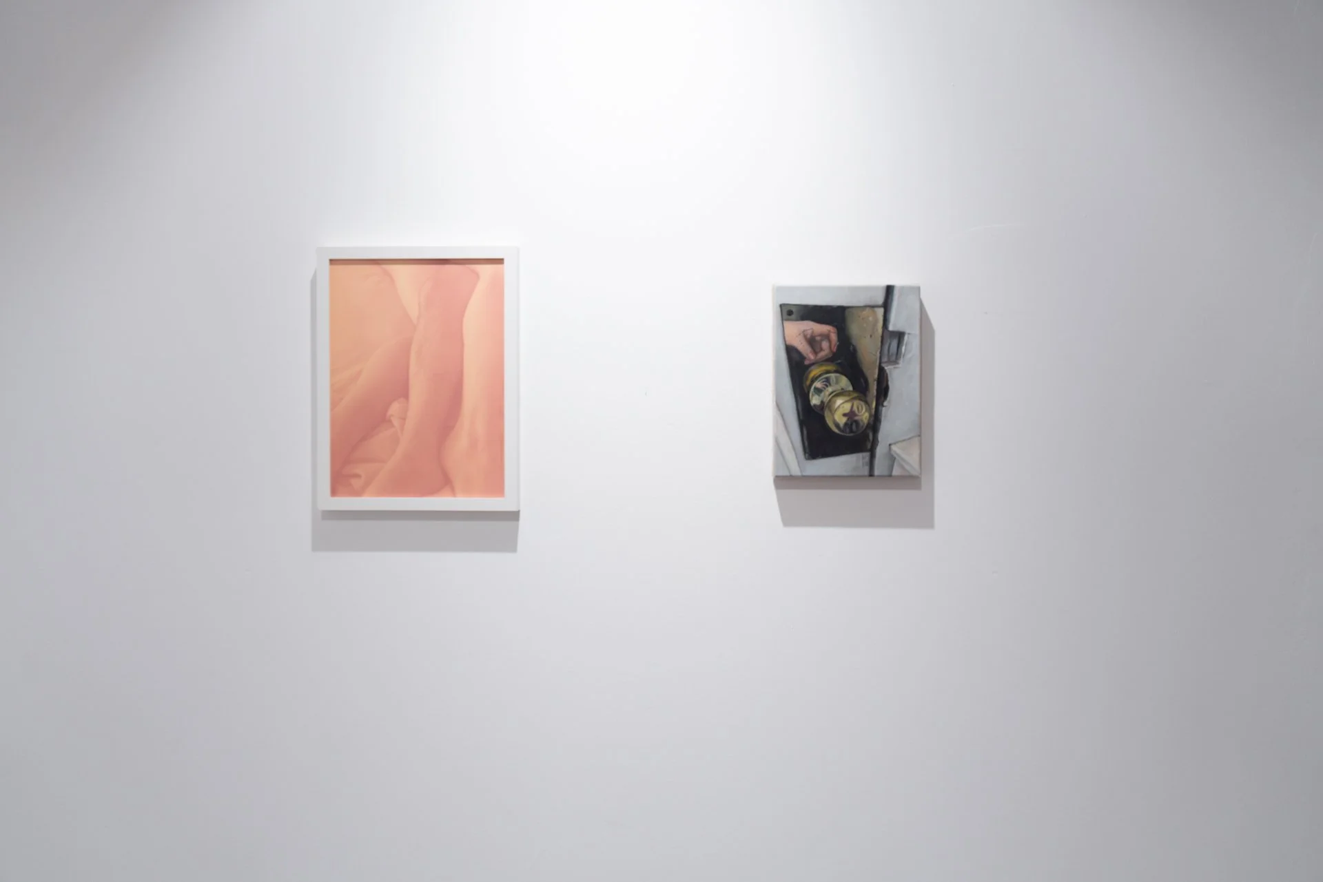 Installation: Yours or Mine