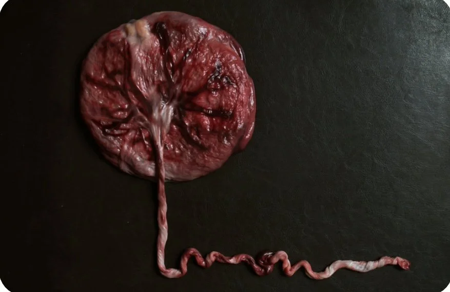PLACENTA2.jpeg