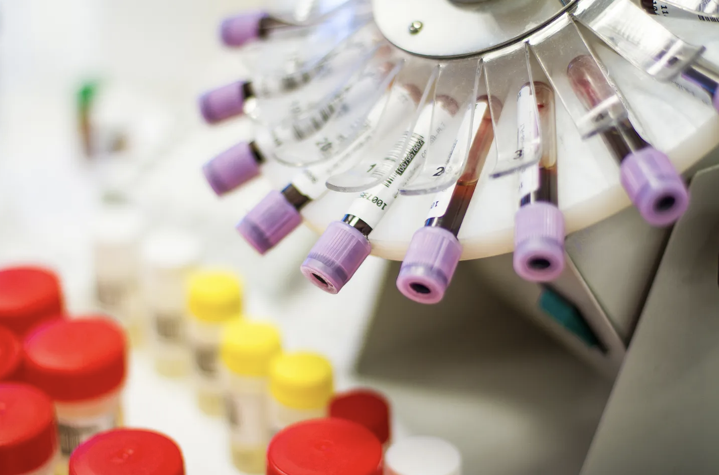 Toxic Risks from Jury Decisions
