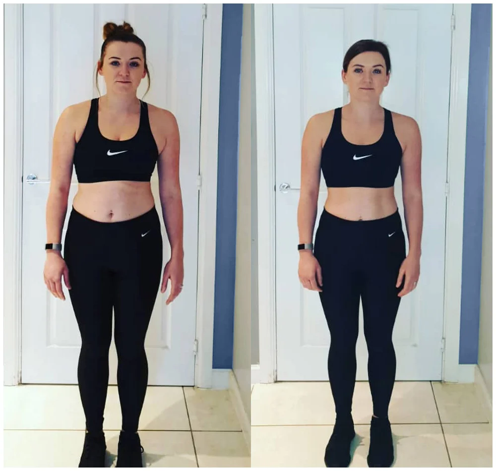 Fat loss Coldfield, Great Barr