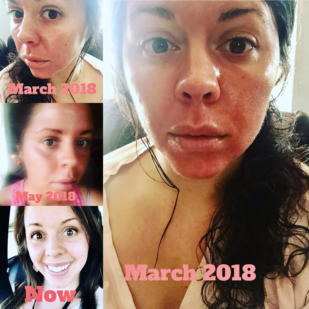 My Healing Journey with Chronic Illness