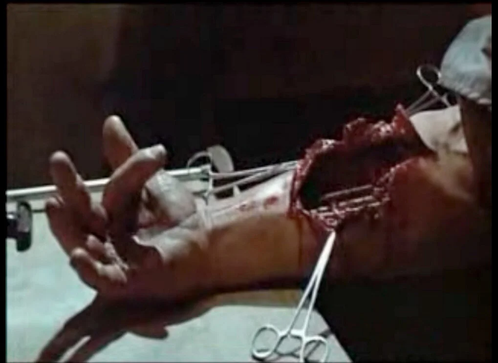 terminator arm.jpg