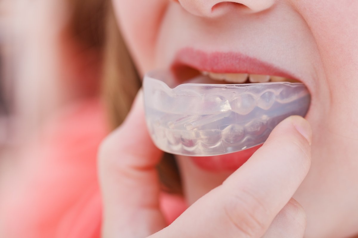 Woman wearing a mouth guard