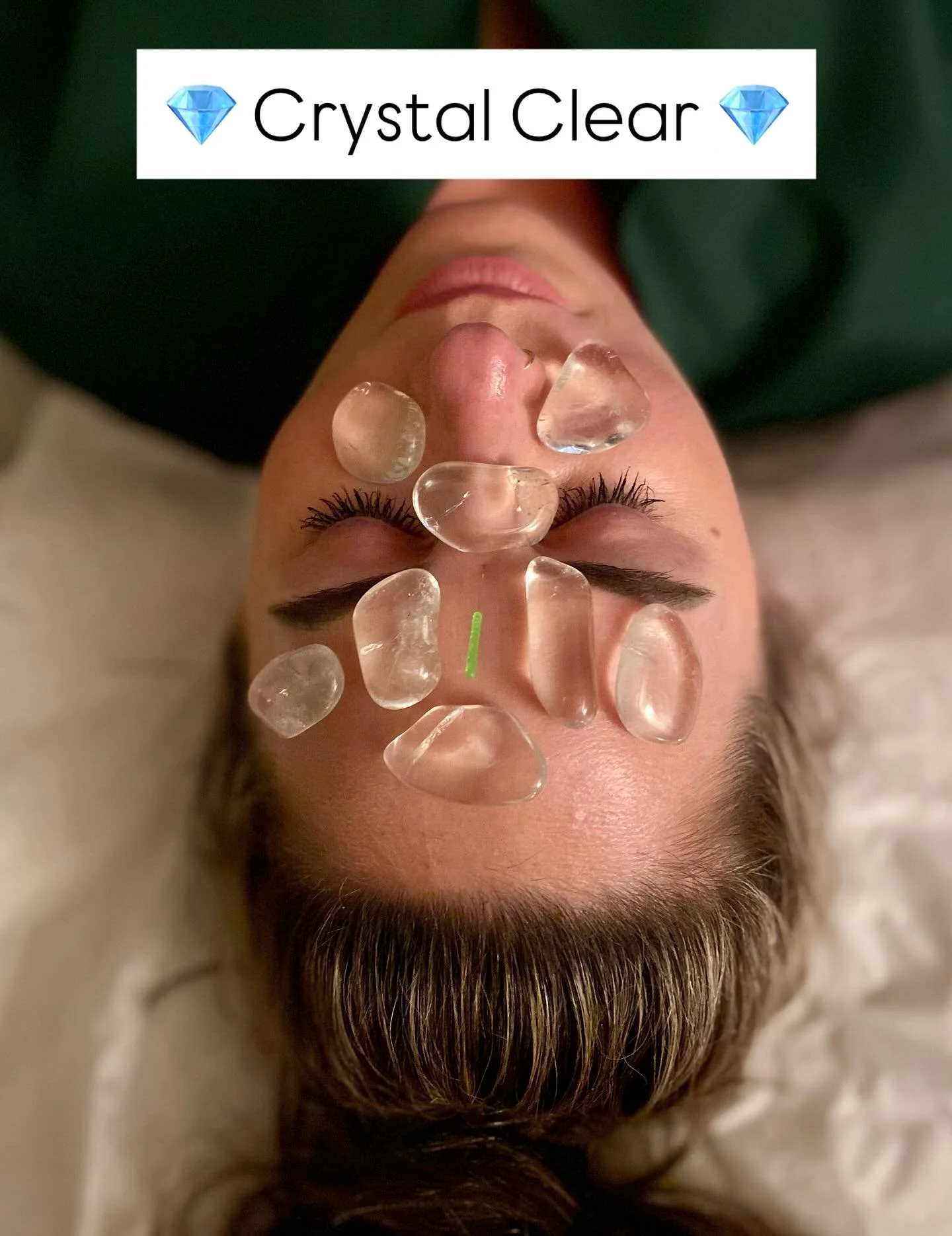 Need clarity? ✨ Sometimes all it takes is a few needles, a pointed intention, and a little help from some clear quartz crystals 💎🧘‍♀️
 #AcupunctureMagic #CrystalClarity #EnergyAlignment #ClearQuartzVibes #acupuncture #crystaltherapy #energy #c