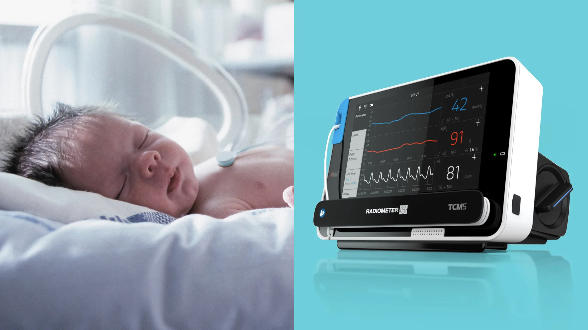 FLUID-Radiometer-TCM5-HERO.jpg