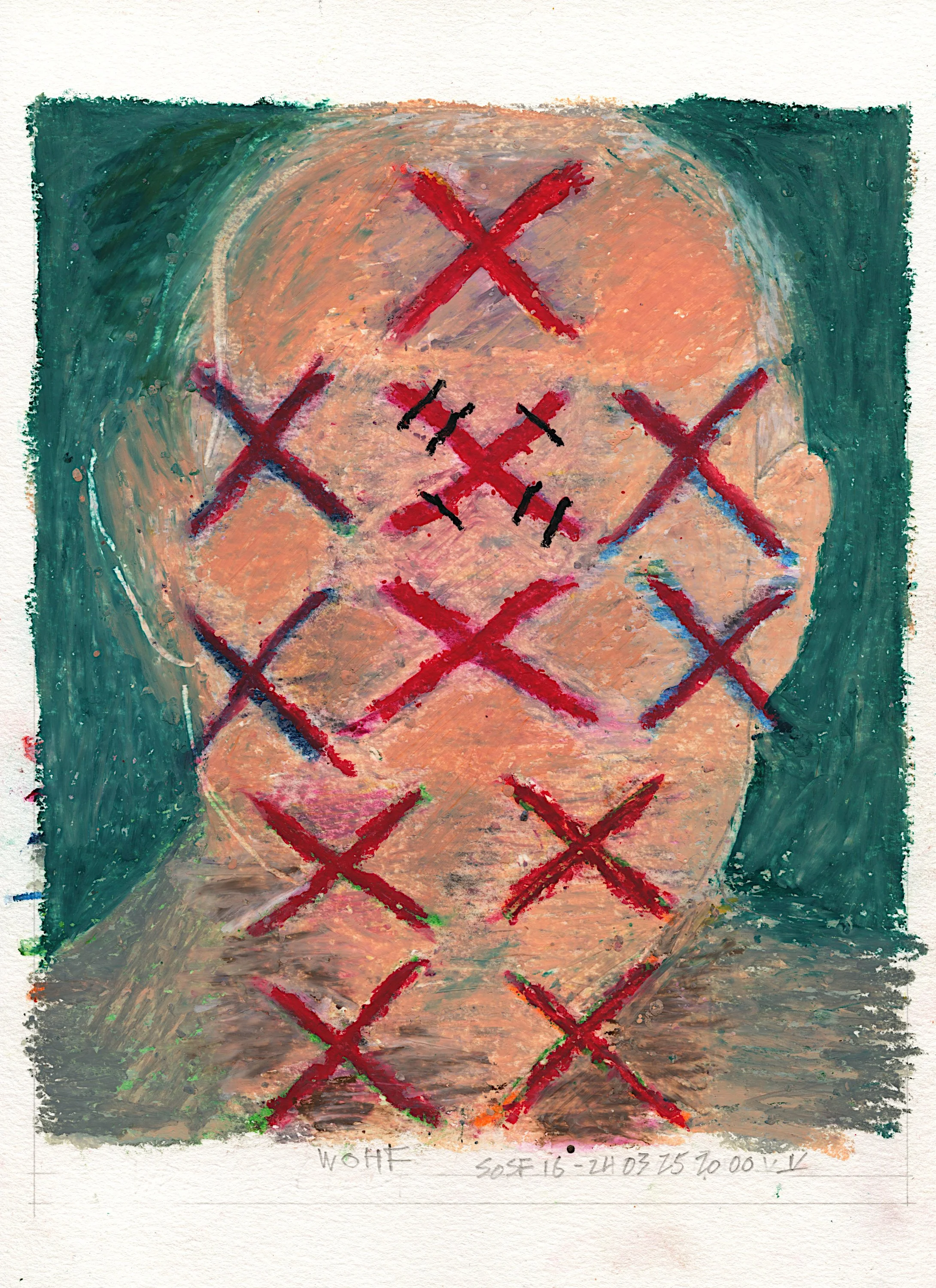 Symbol #16 - Wounds (Sold)