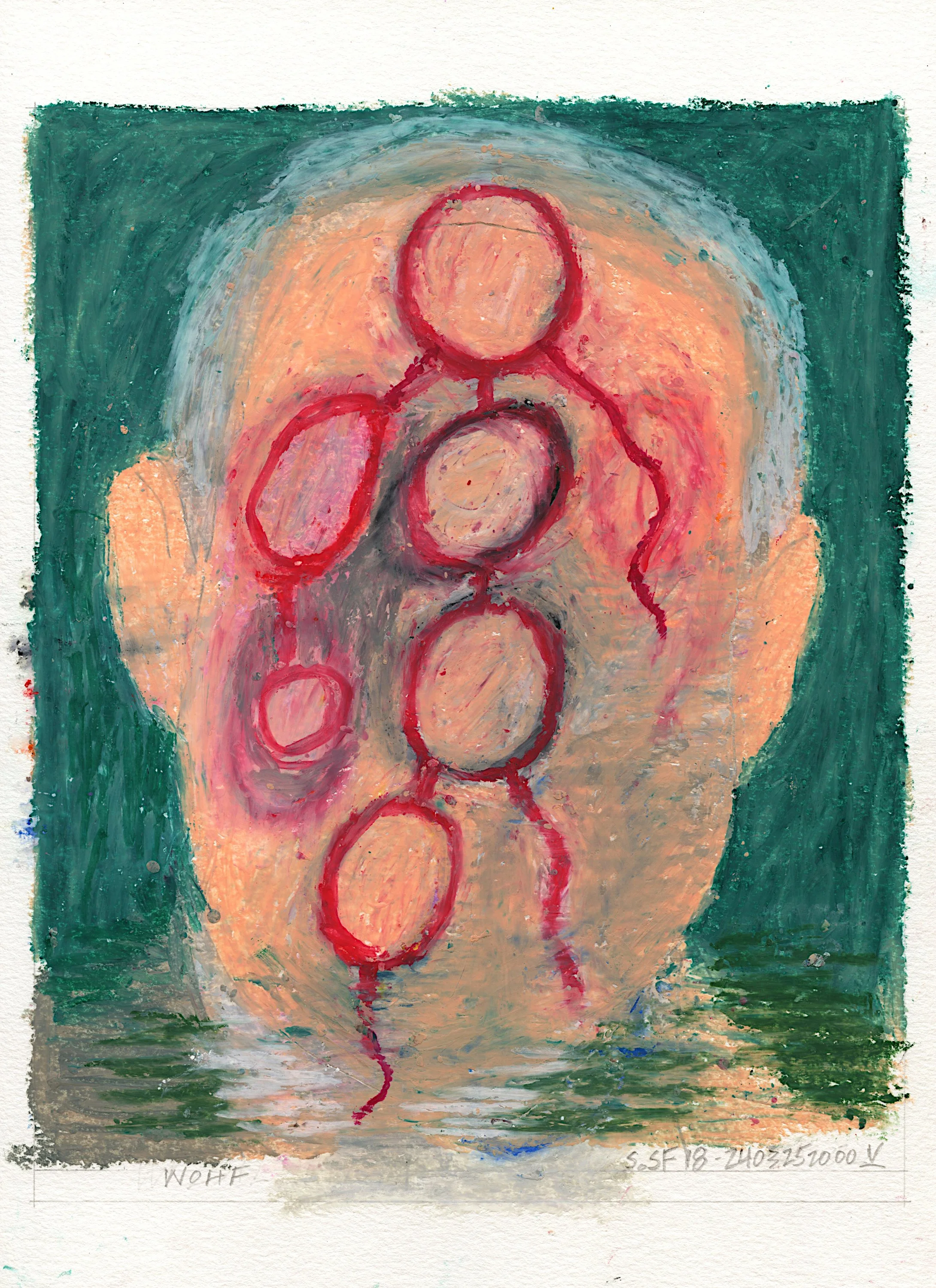 Symbol #18 - Amputated (Sold)
