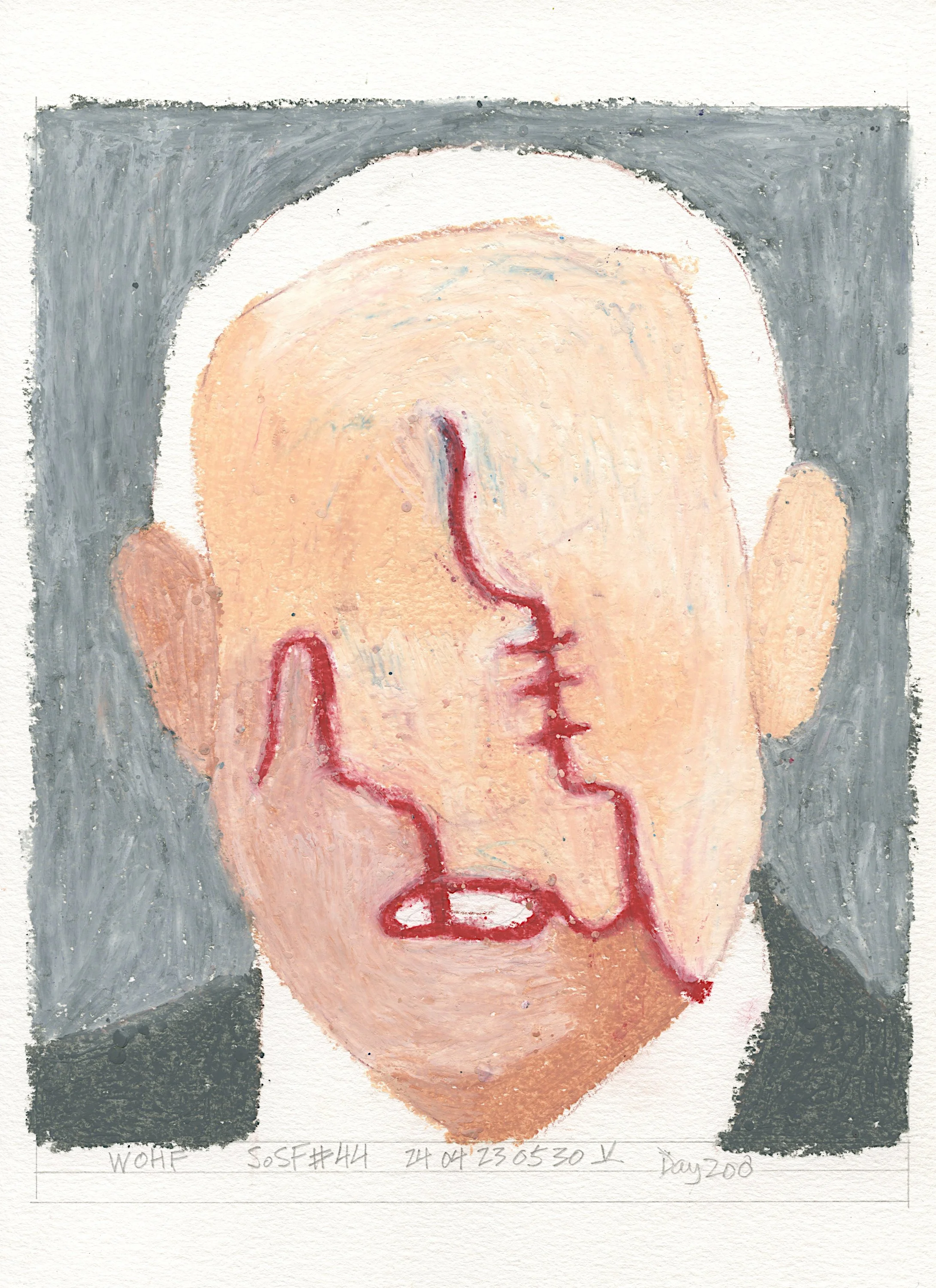 Symbol #44 - Baby "S" Facial Injury (Sold)