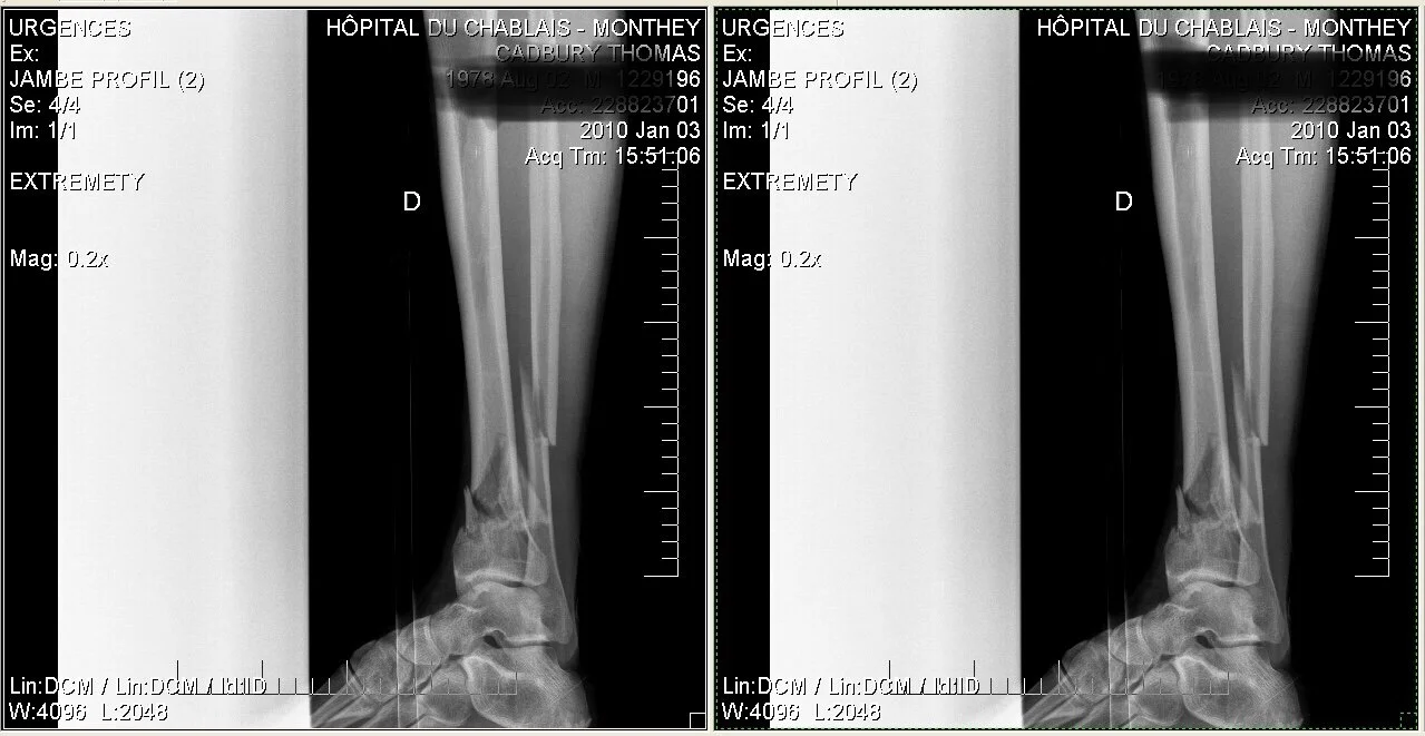 Keeping focus - by Tom Cadbury
