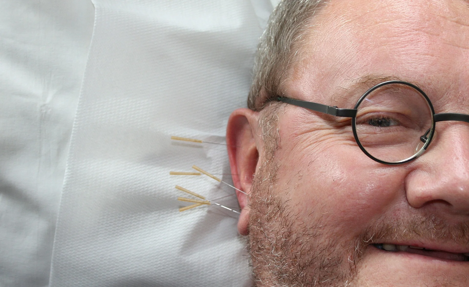 acupuncture-364613_1920.jpg