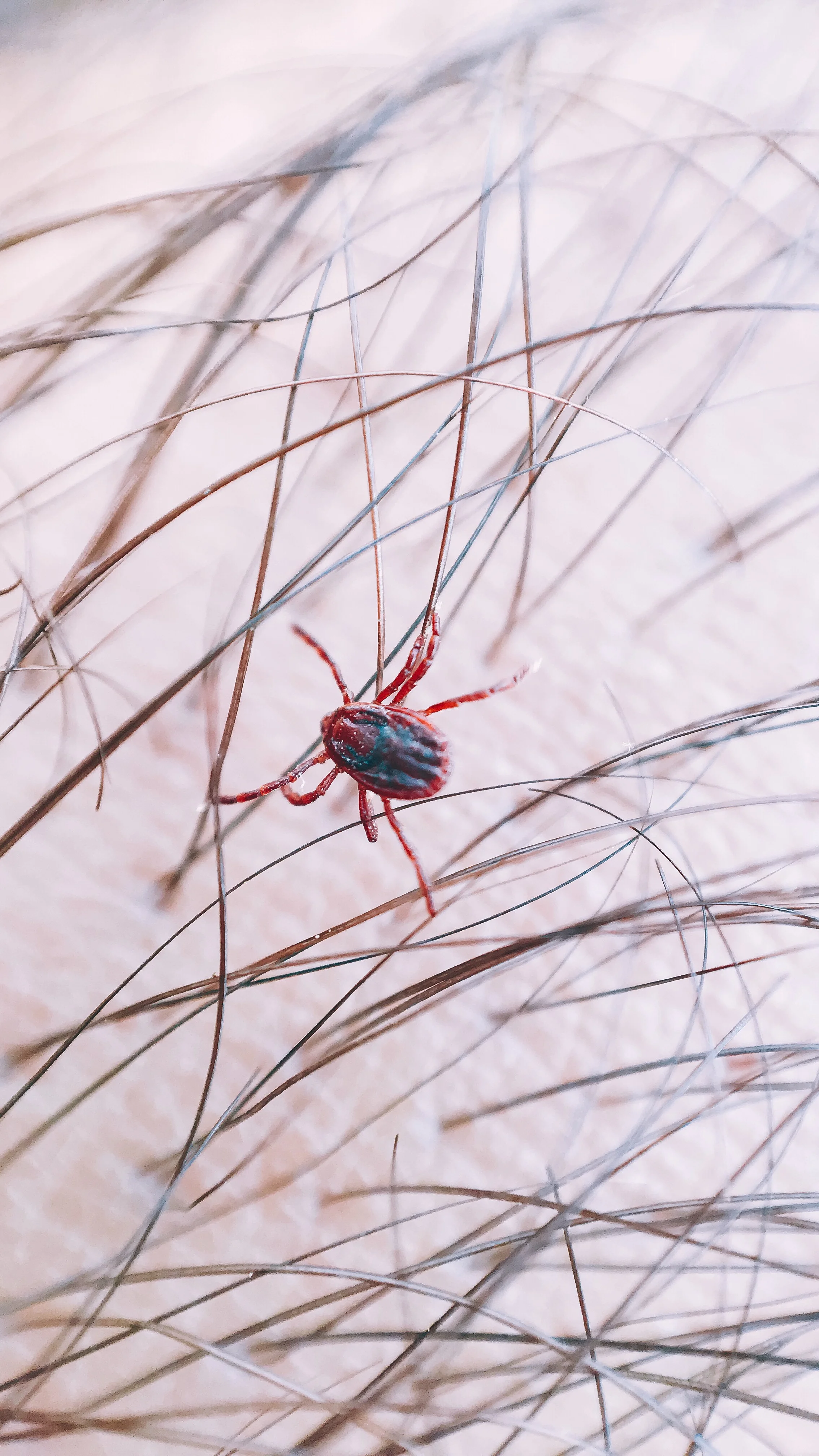 Lyme: The First Epidemic of Climate Change
