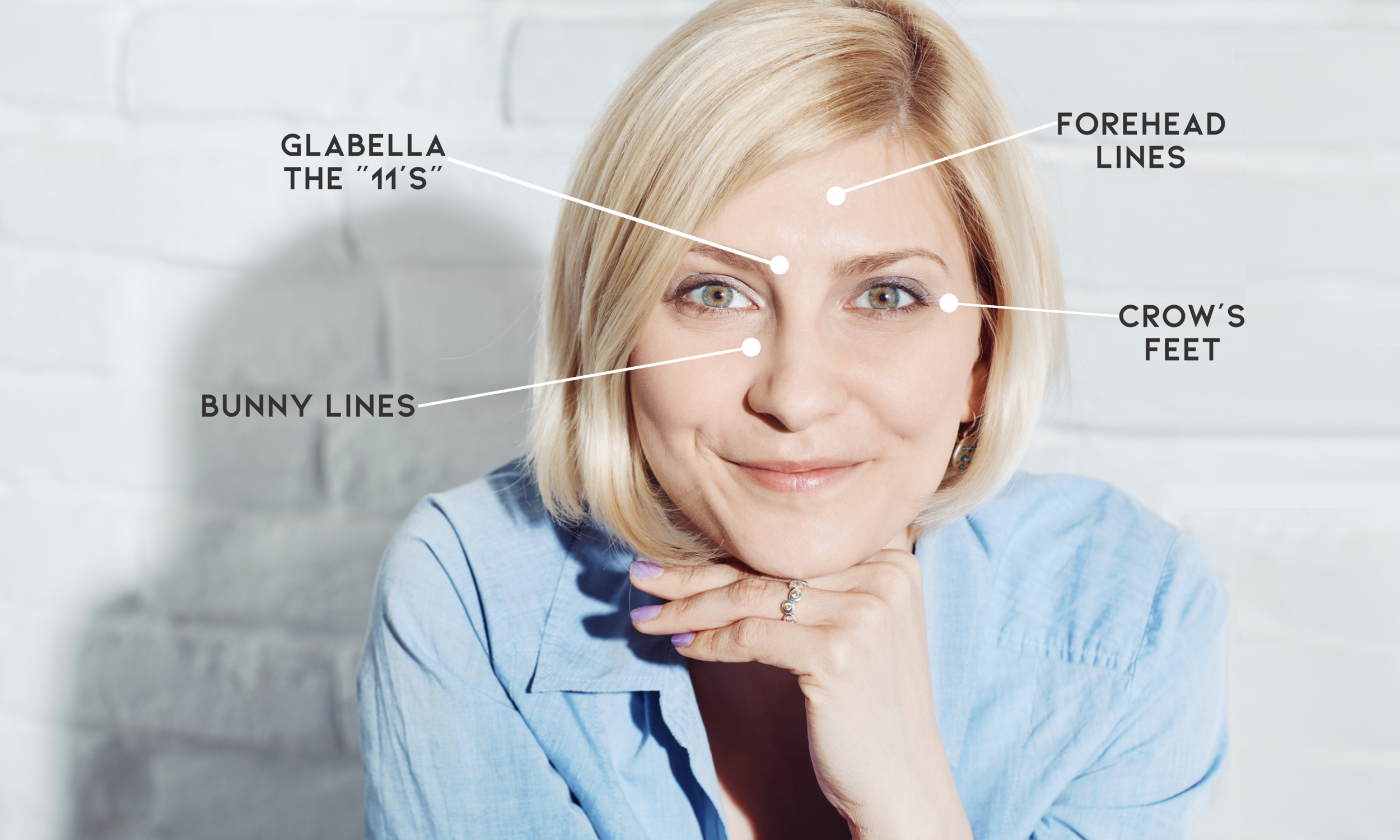 Website _ Botox_Dysport (4).png