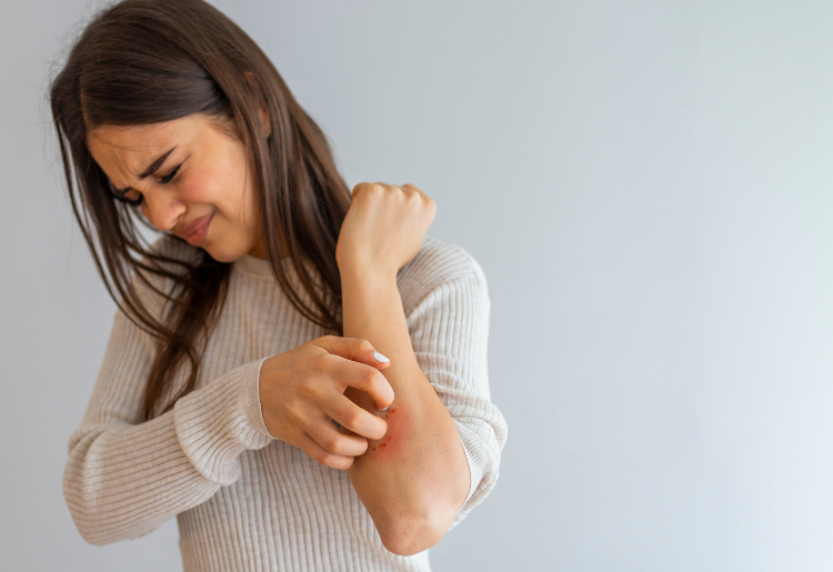 Understanding Psoriasis