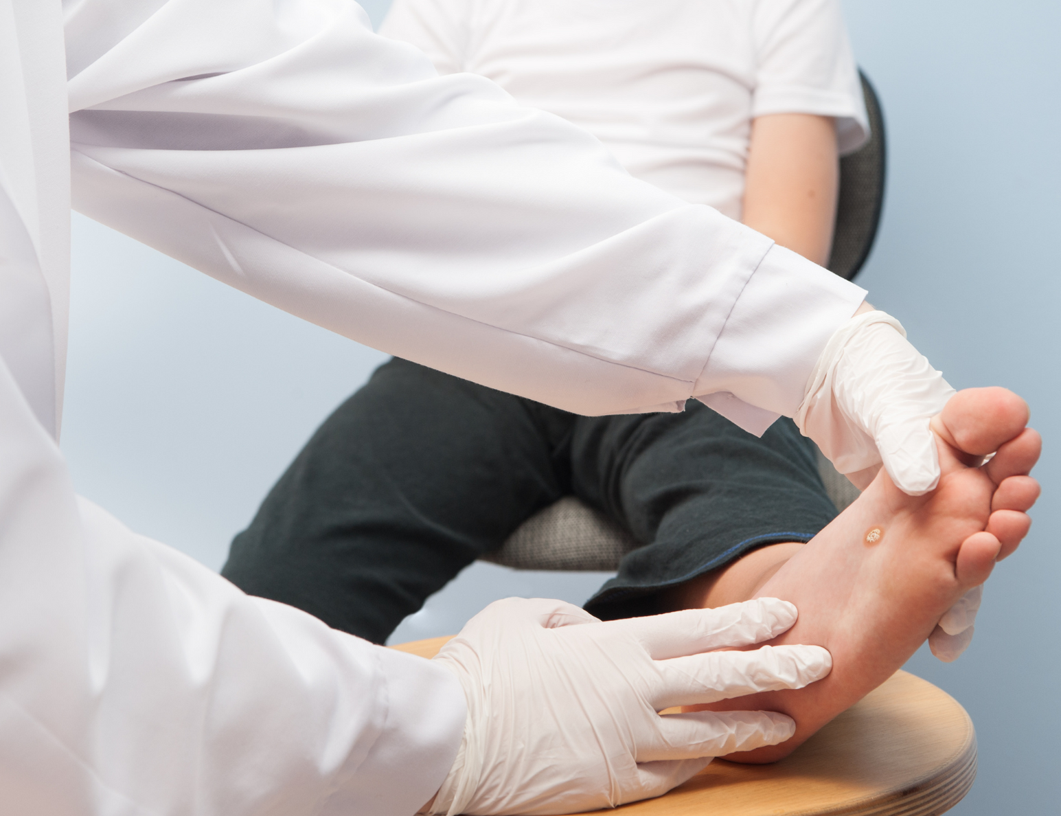 FIGHTING THE WART WAR