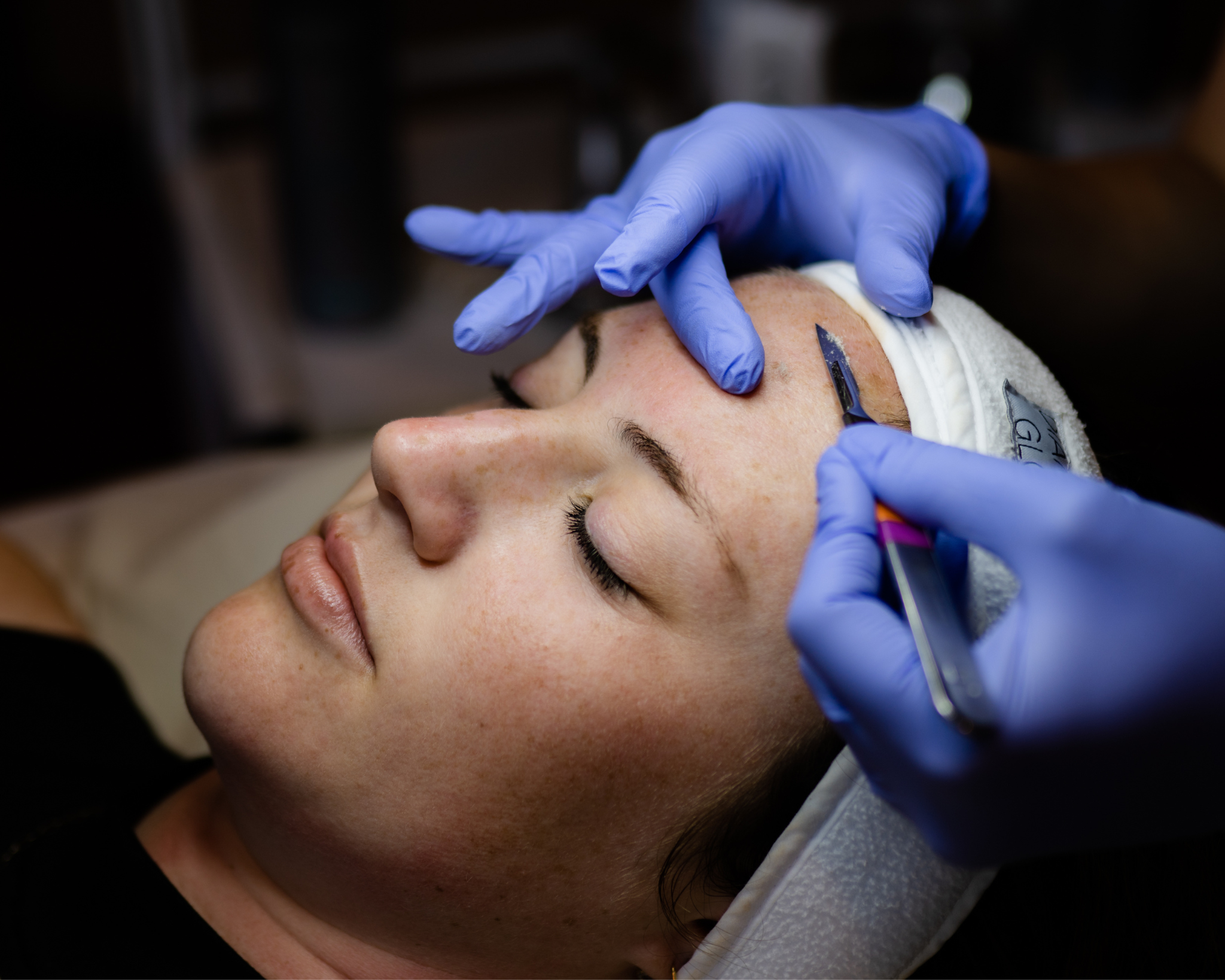 Dermaplaning — Three Rivers Dermatology