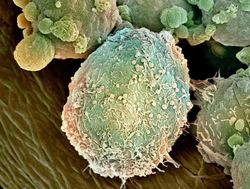 Single-cell multi-omics sheds light on the importance of tissue heterogeneity