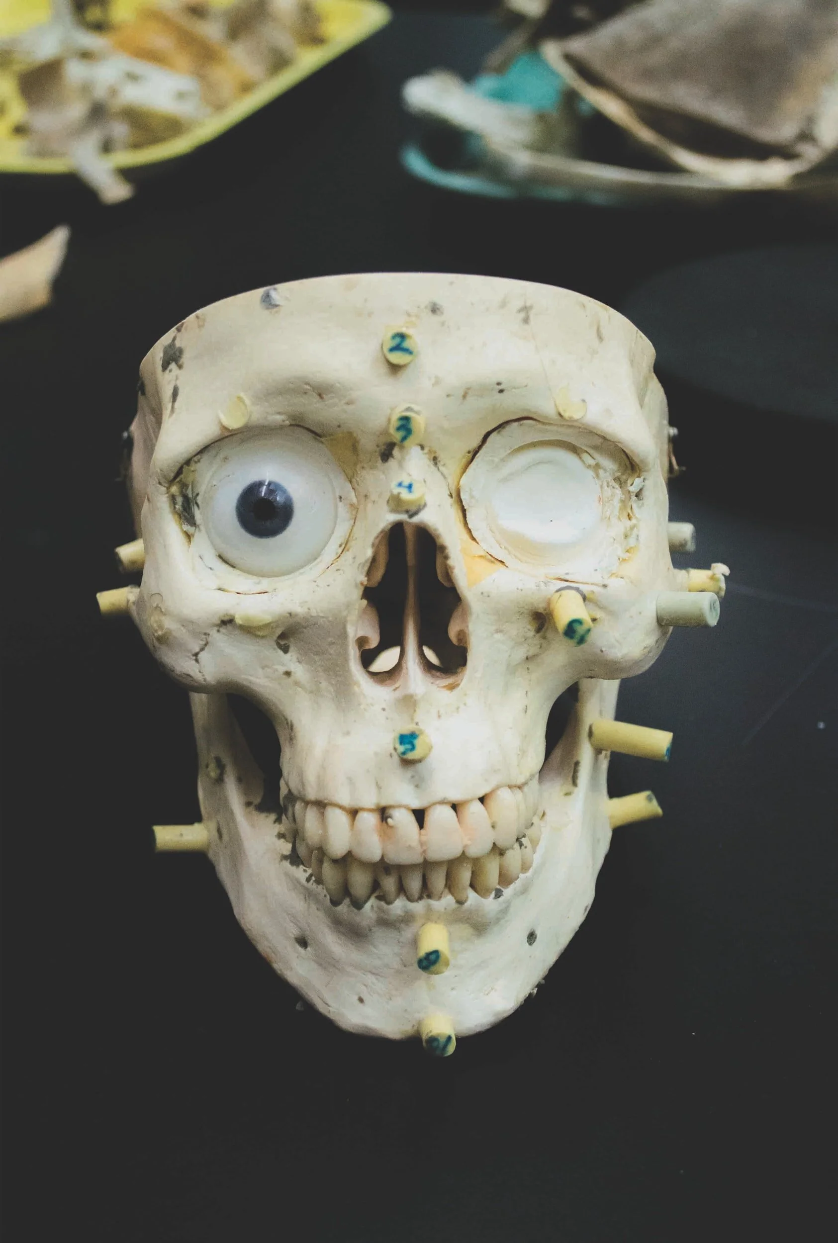 คําถาม ที่พบบ่อยในการทําศัลยกรรมกระดูกใบหน้า