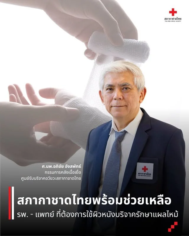 สภากาชาดไทยพร้อมช่วยเหลือ รพ. – แพทย์ ที่ต้องการใช้ผิวหนังบริจาครักษาแผลไหม้