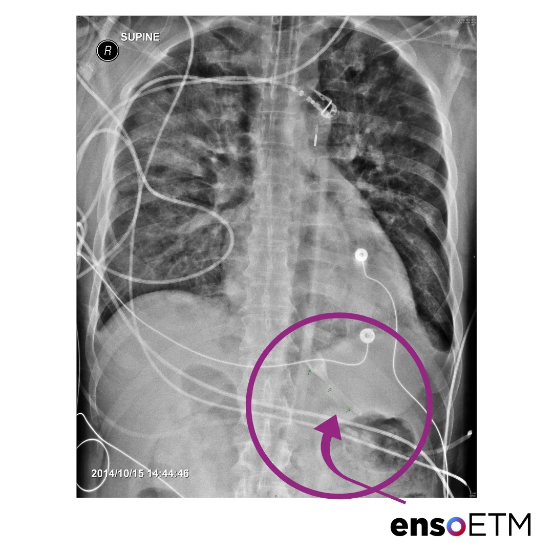 XrayCIRCLE.jpg