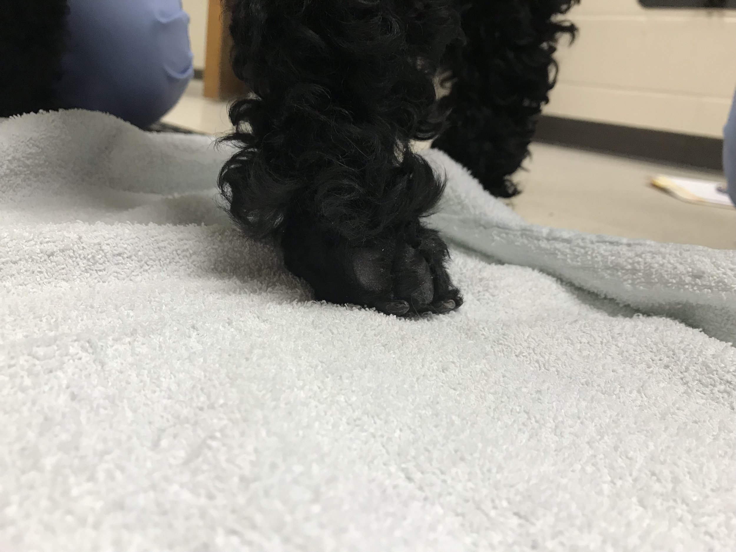 Brachial Plexus Injury and Recovery