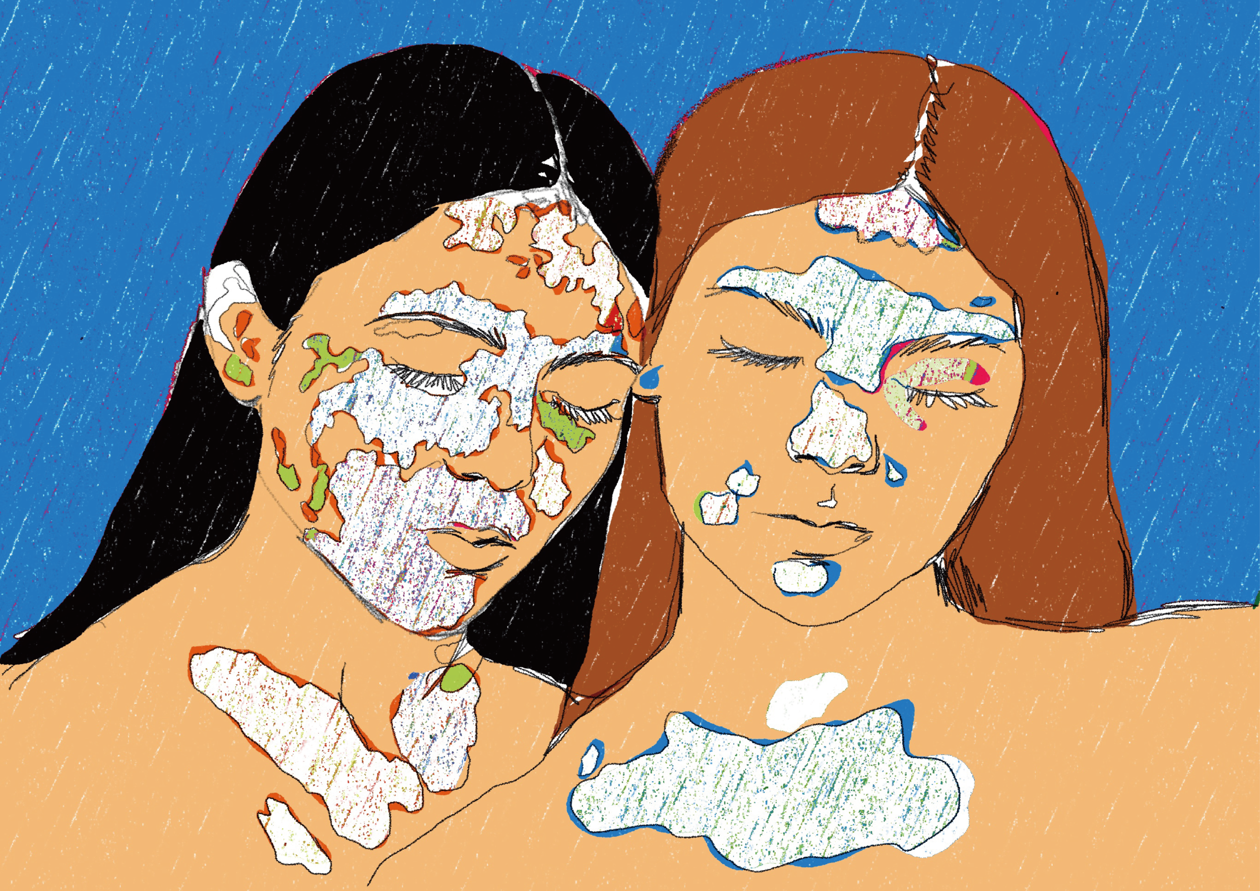 Vitiligo Portrait Art