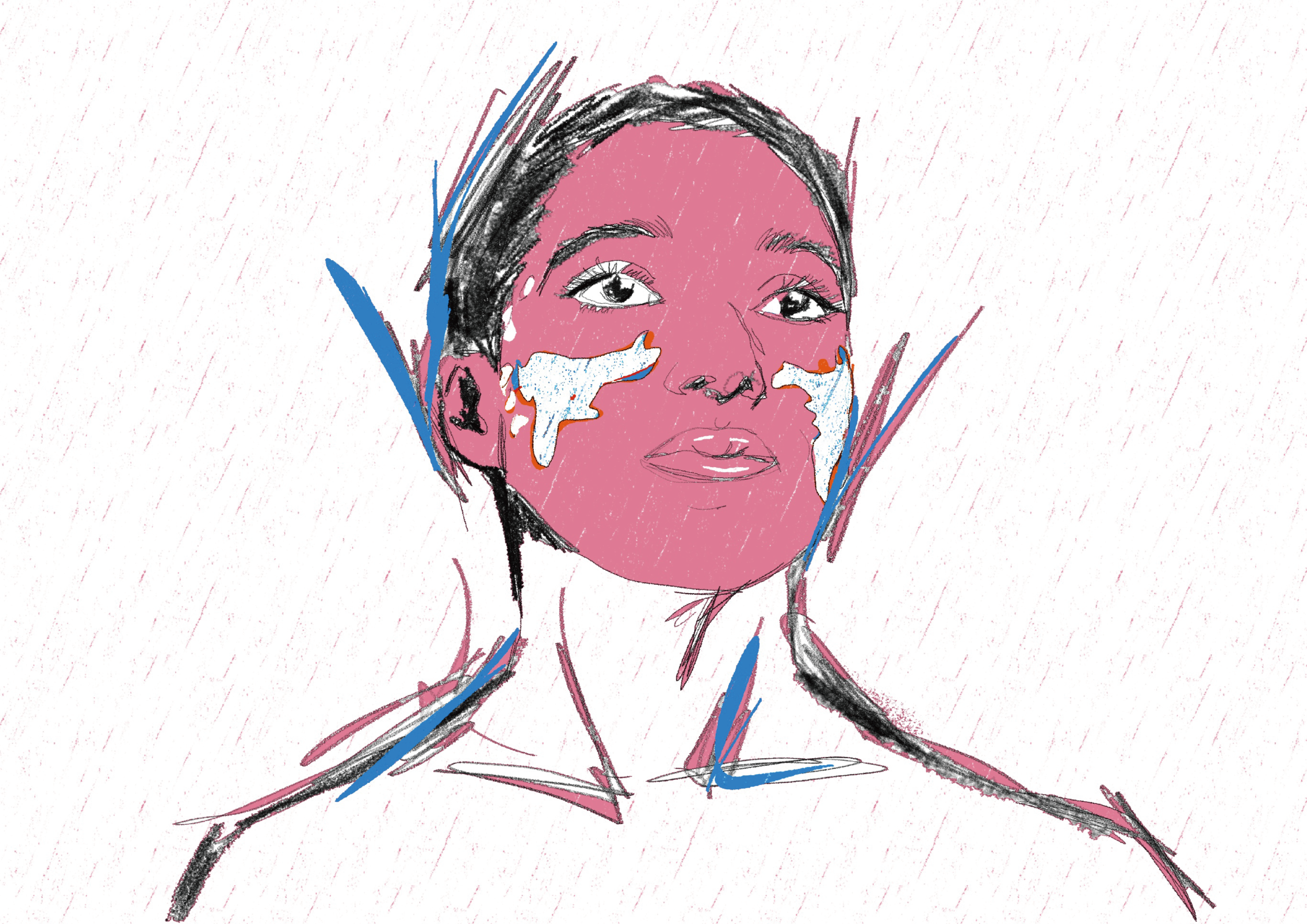 Vitiligo Portrait Art