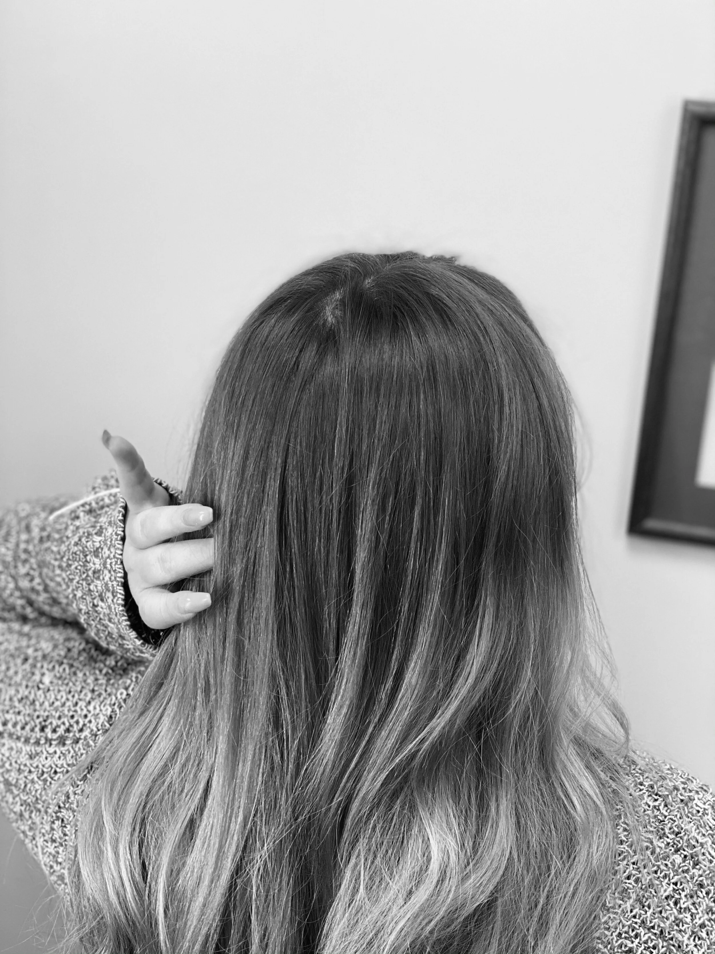 Let's Talk About Dandruff 