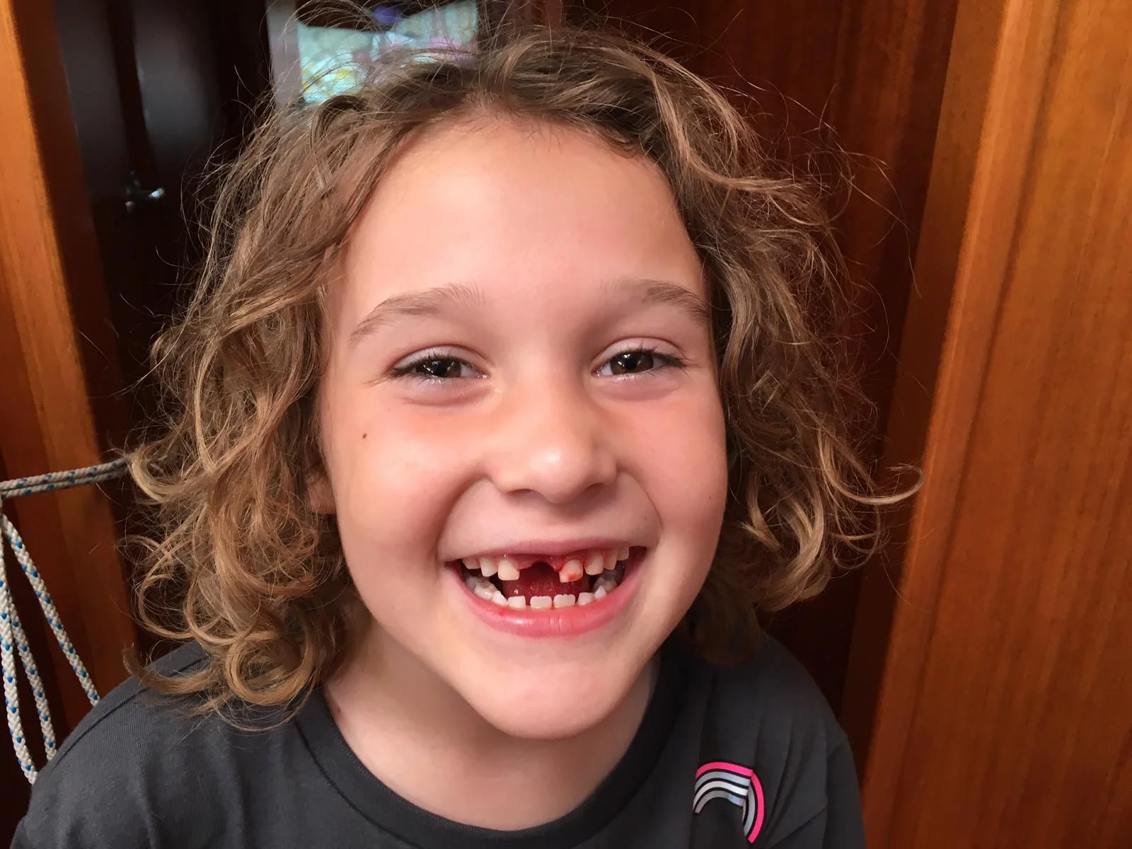 I lost my tooth today!