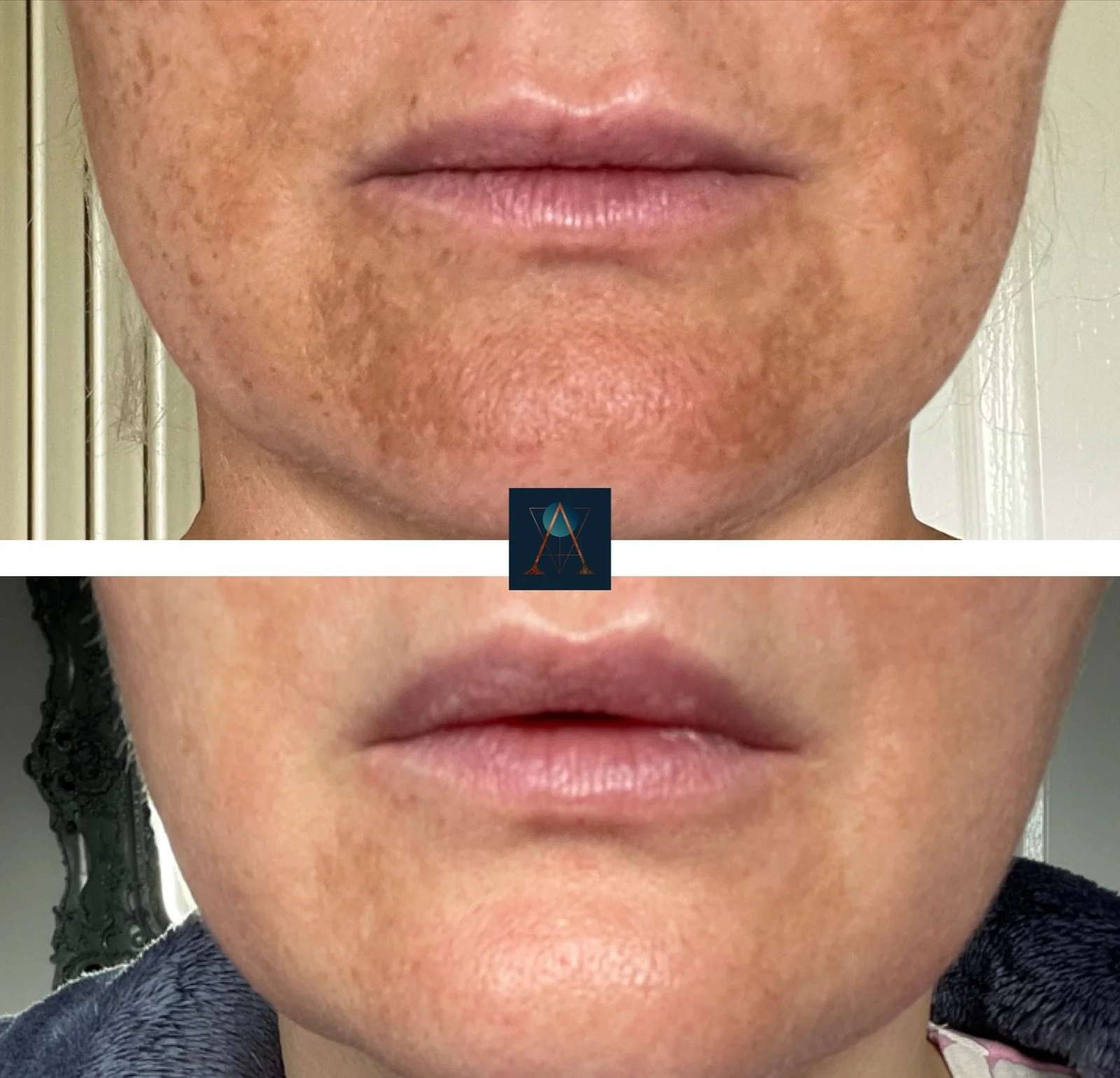 eZy Watermark_10-01-2024_07-50-15-2170pm.jpeg