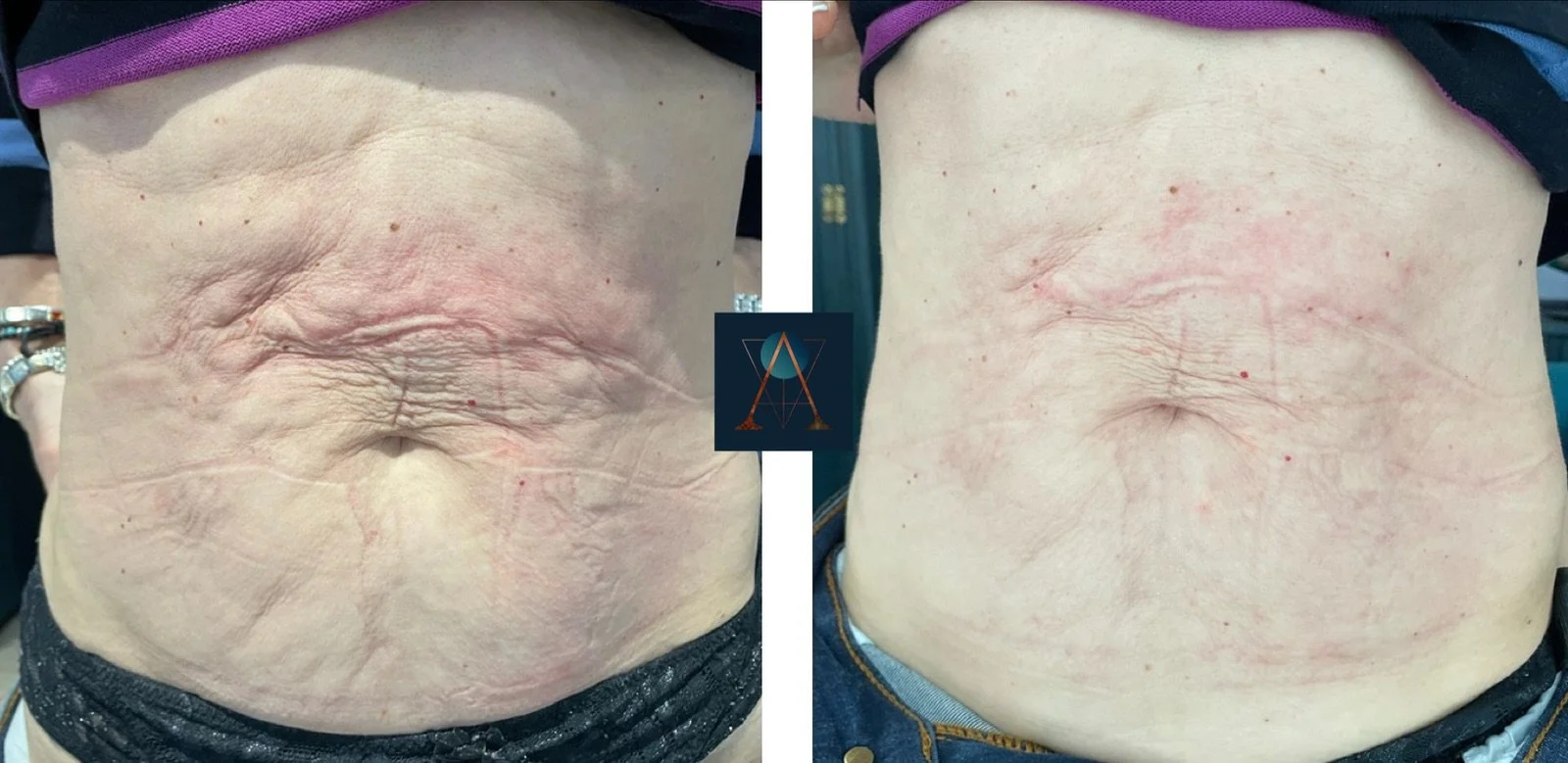 eZy Watermark_10-01-2024_07-43-50-7500pm.jpeg