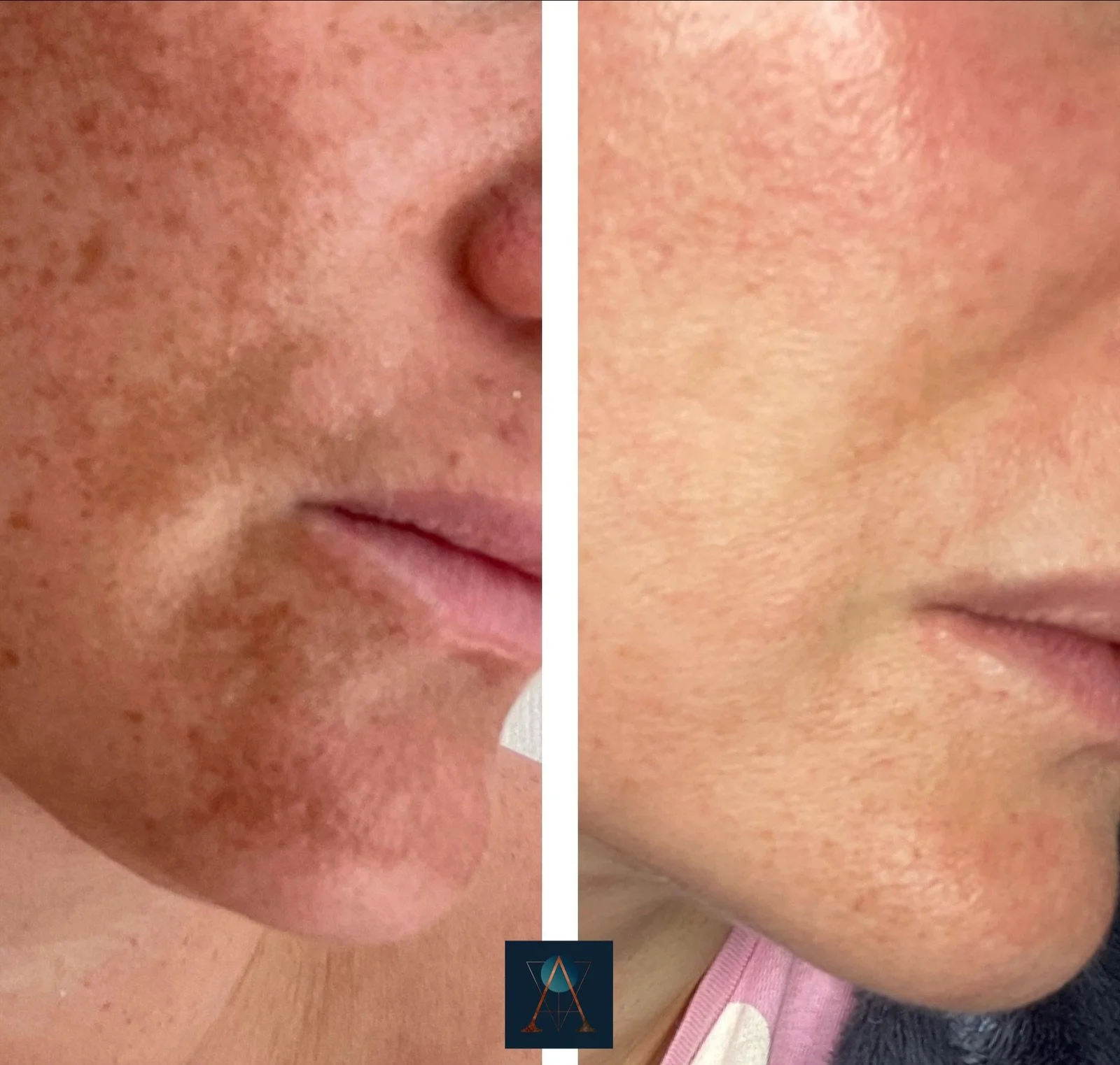 eZy Watermark_10-01-2024_07-53-13-5020pm.jpeg