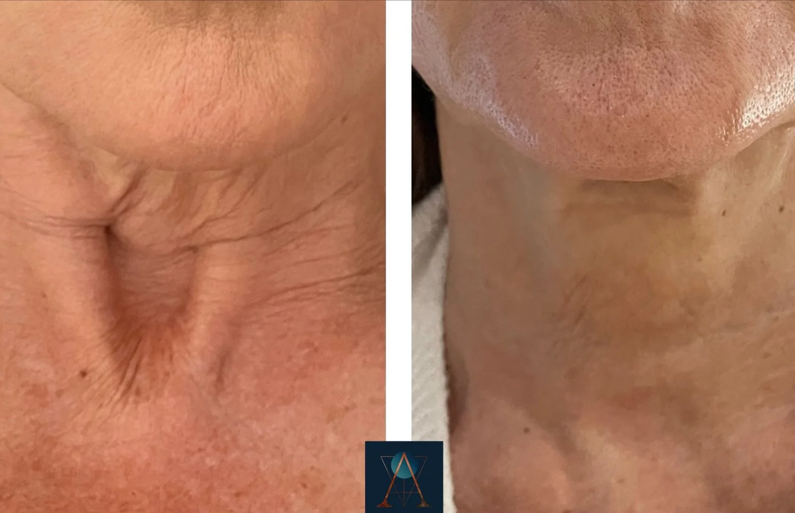 eZy Watermark_10-01-2024_07-31-03-3850pm.jpeg