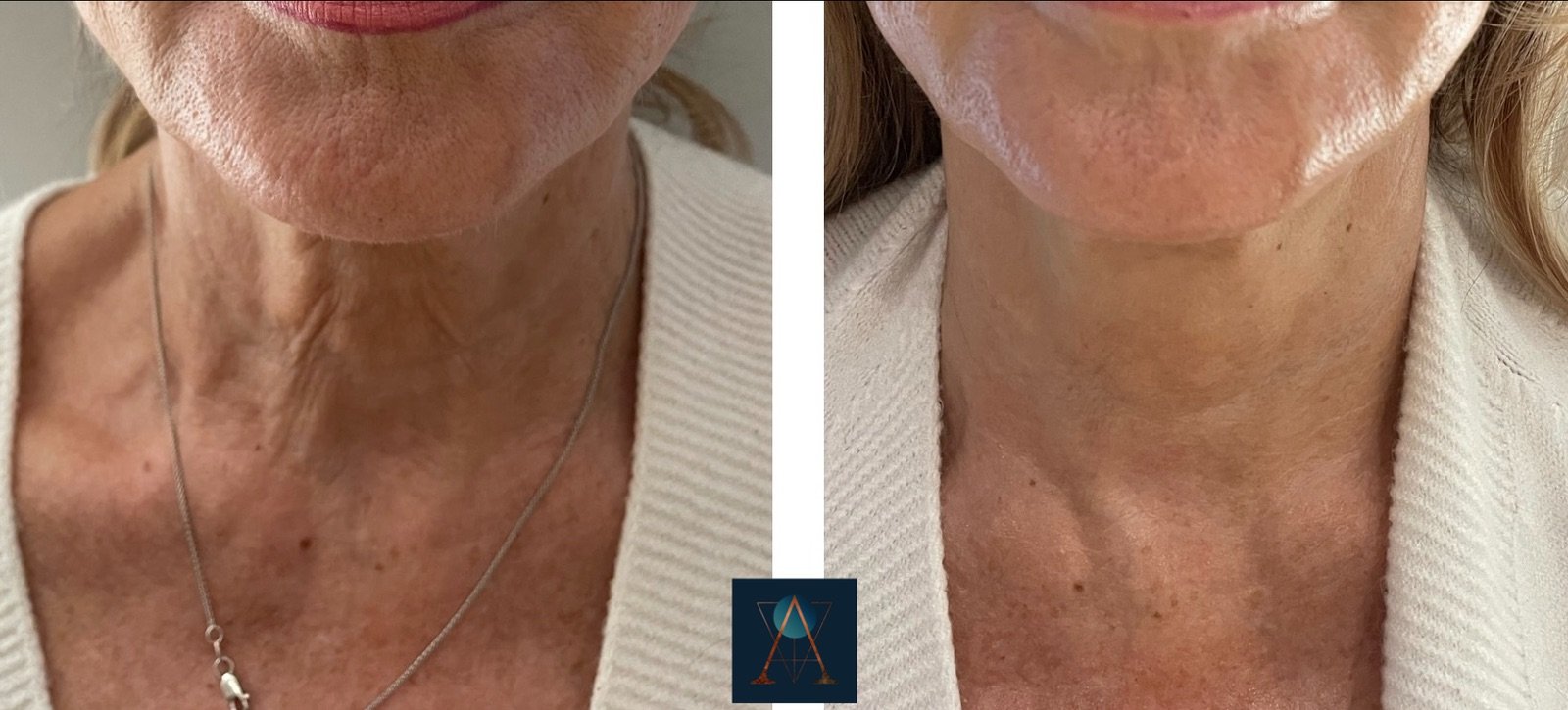 eZy Watermark_10-01-2024_10-08-40-4420am.jpeg