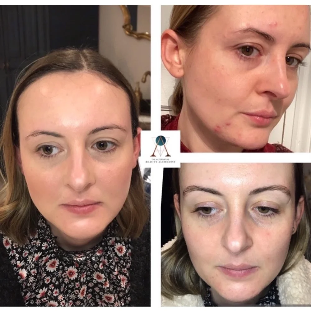 Alchemist Facials The Alternative Beauty Alchemist Alchemist Facials The Alternative Beauty Alchemist